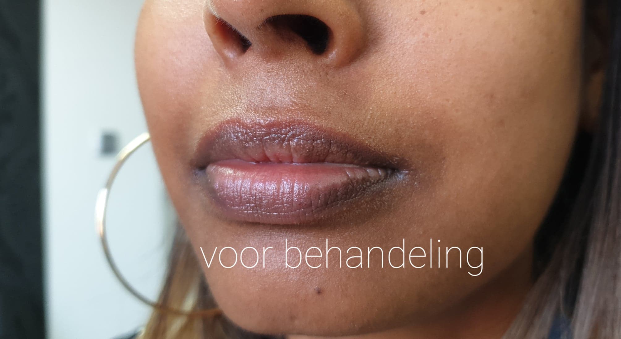 Beautysalon en Permanente makeup Alicia Donkere lippen oplichten ( Neutralisatie)